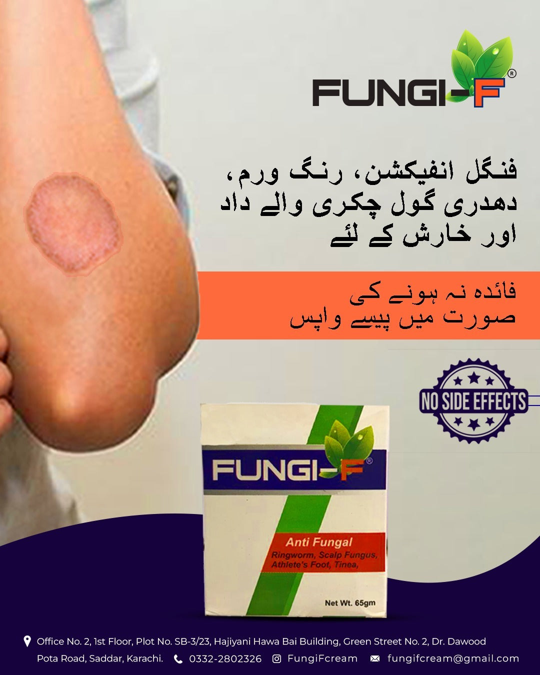 Fungi F cream